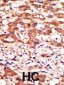 MGAT1 Antibody (N-term)